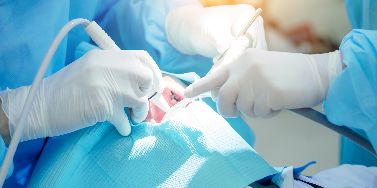 インプラントの骨が足りないときに有効な骨造成技術3