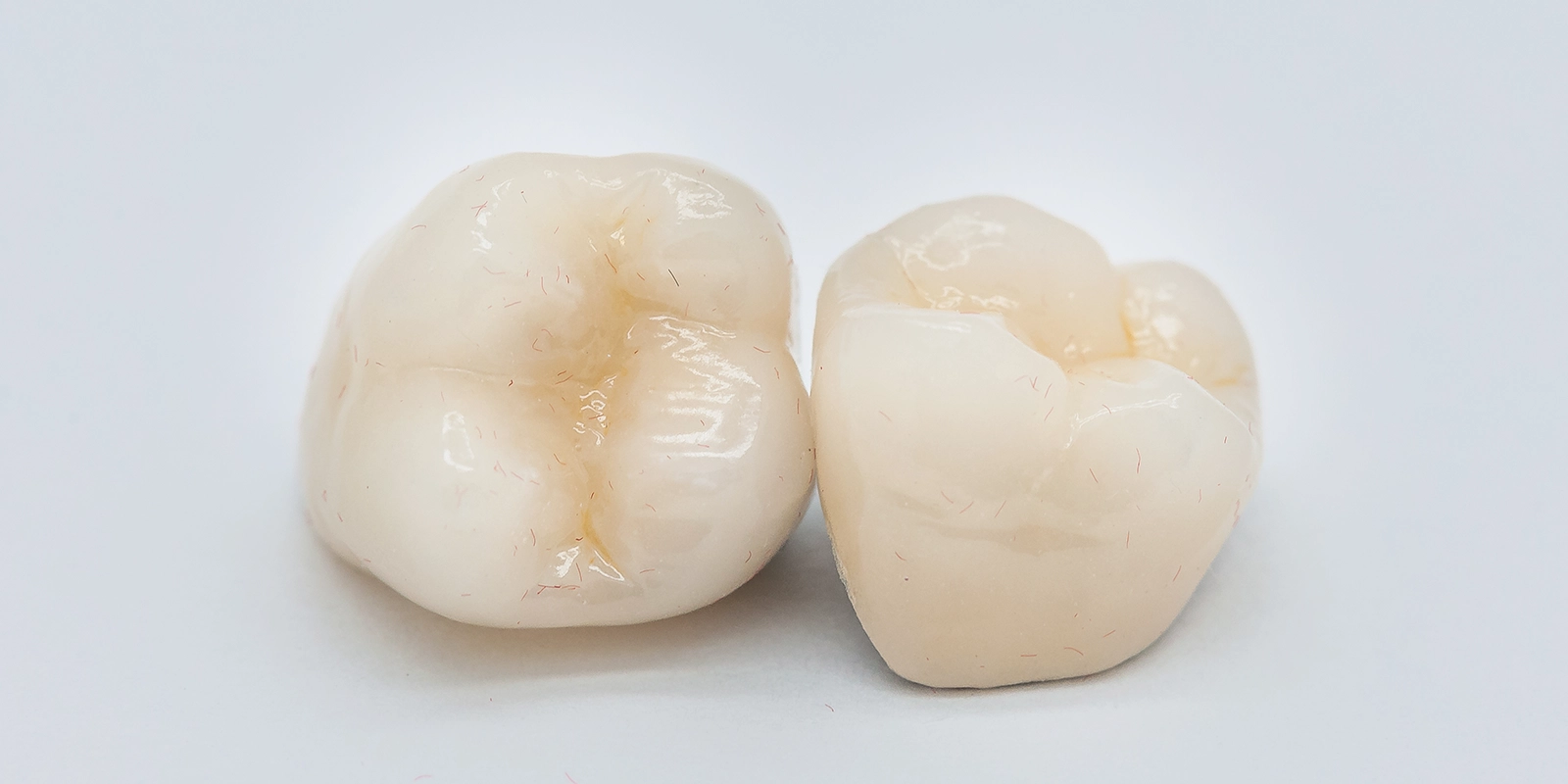 奥歯にはジルコニア