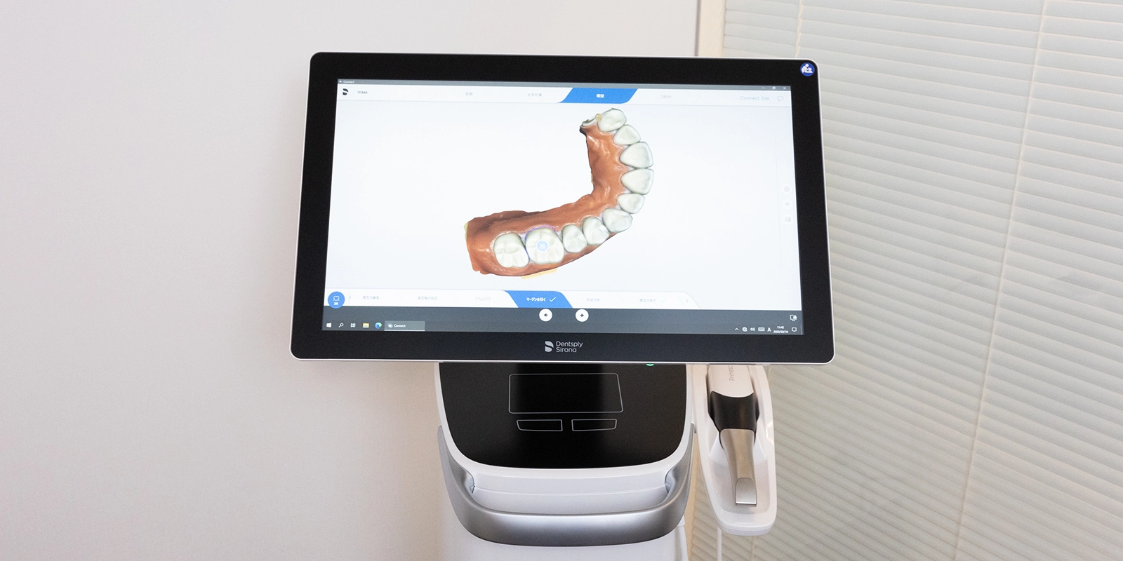 プライムスキャンによる精密治療