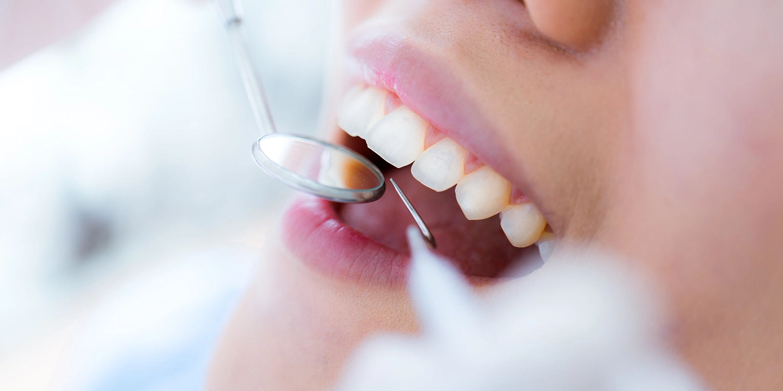 治療後のサポート体制