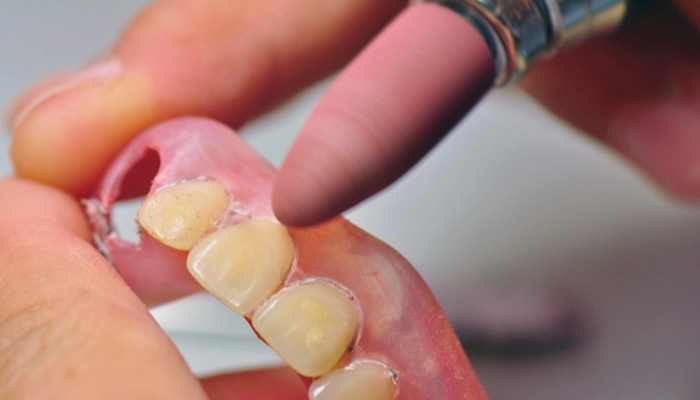 入れ歯とはどのような治療か