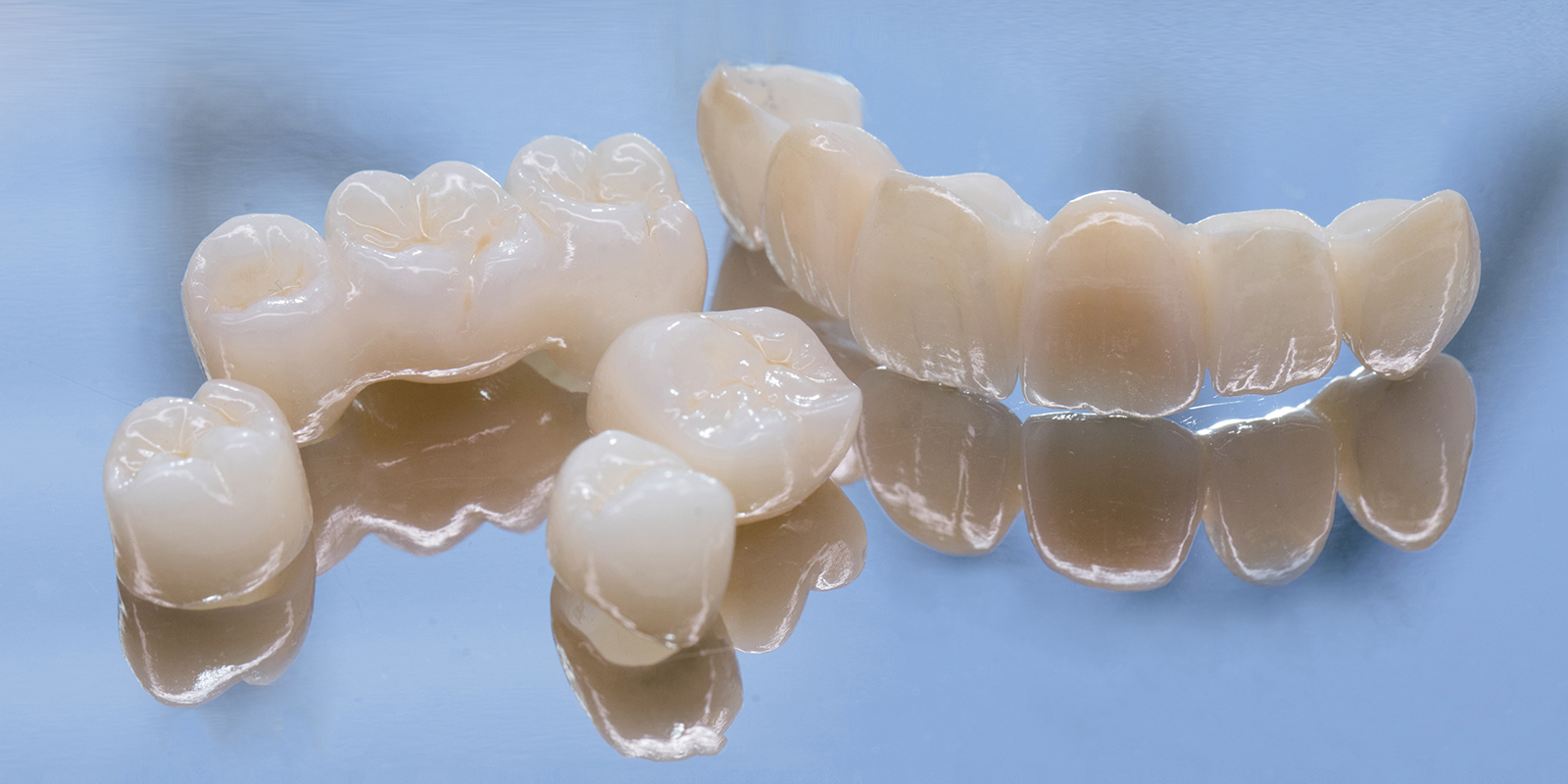 審美セラミック治療